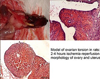 Ovarian torsion. Present in rats.