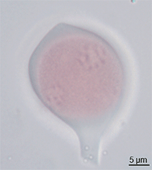 Pollen microspores of Solanum lycopersicum at coenocytic tetrad stage of development observed through oil immersion microscope; the chromosomes of what will become four pollen grains can be seen.