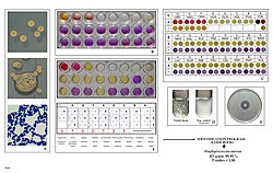 Key characteristics of Staphylococcus aureus