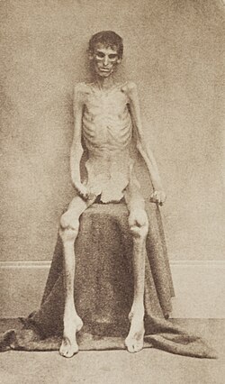 Union soldier held as a POW