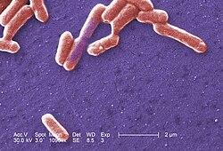 Scanning electron micrograph of an E. coli colony