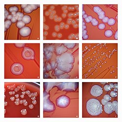 The pronounced phenotypic diversity within Escherichia coli strains isolated from patients with UTIs.