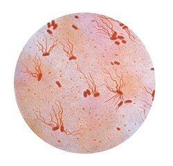 Typhoid bacteria shown under a microscope with flagellar stain