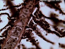 Freshwater fish gills magnified 400 times