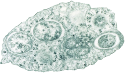Wolbachia bacteria within an insect cell