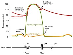 The x-axis reflects time with a recording of the heart sounds. The y-axis represents pressure.[8]