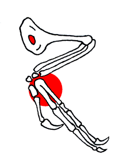 Diagram of the arm bones; note the hole in the humerus