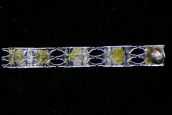 Benthic diatom