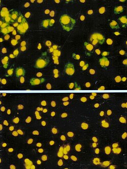 Immunoflourescence: Cells infected by rotavirus (top) and uninfected cells (bottom)
