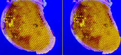 Stereo images of the eye