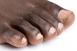 Human toes