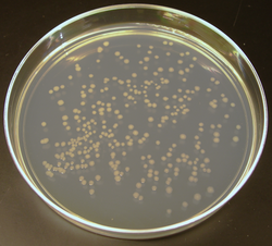 Colonies of E. coli produced by cellular cloning. A similar methodology is often used in molecular cloning.