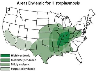 Histoplasmosis endemism map for the U.S.