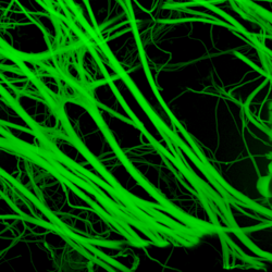 Thick elastic fibres from the visceral pleura (outer lining) of lung