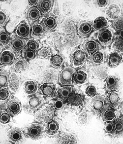 Herpes simplex virions, TEM. Herpes simplex virus is one of the many viruses Iwasaki studies.