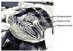 Frontal section showing papillary muscles attached to the tricuspid valve on the right and to the mitral valve on the left via chordae tendineae.[8]