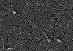 Human spermatozoa