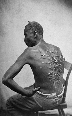 Carte de visite image of Peter, taken in Baton Rouge spring 1863; widely distributed by abolitionists to expose the brutality of slavery