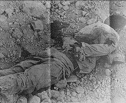 An Iraqi POW who was shot by Iranian troops after they conquered the Iraqi Majnoon oil field in October 1984
