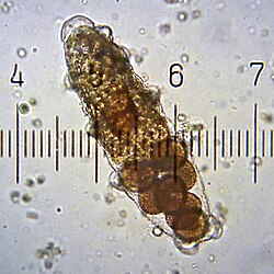 Shed cuticle of female tardigrade, containing eggs, each 50μm across