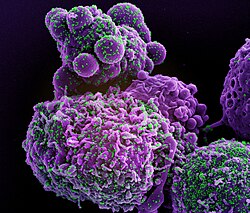 Scanning electron micrograph (colorised) of cell infected with the Omicron strain of SARS-CoV-2 virus particles green