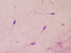 Human sperm stained for semen quality testing