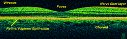 Time-Domain OCT of the macular area of a retina at 800 nm, axial resolution 3 μm