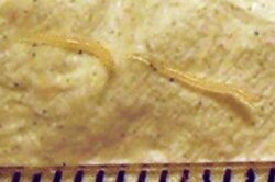 Two pinworms