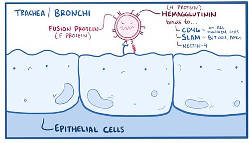 Drawing of the measles virus attaching to the lining of the trachea