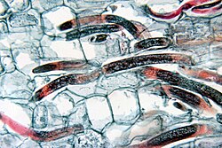 Radopholus similis inside banana root, causing nematode root rot