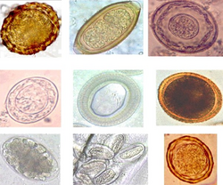 Eggs of different species of parasitic worm