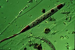 Nomarski micrograph of a ruthenium red-stained nematocyst from Aiptasia pallida, the pale anemone. The red dye stains the polyanionic venom proteins found inside the capsule of this partially-discharged nematocyst.