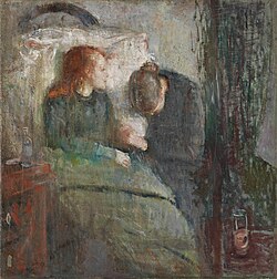 Painting The Sick Child by Edvard Munch, 1885–1886, depicts the illness of his sister Sophie, who died of tuberculosis when Edvard was 14; his mother also died of the disease.