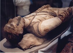 An Egyptian mummy in the British Museum – tubercular decay has been found in the spine.