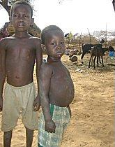 Malnourished children in Niger, during the 2005 famine