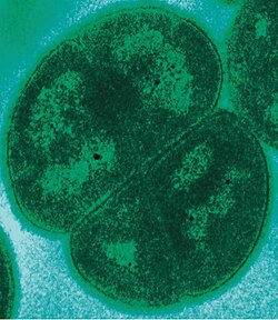 A tetrad of Deinococcus radiodurans, a radioresistant extremophile bacterium