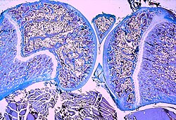 Light micrograph of a section through a juvenile knee joint (rat) showing the cartilagineous growth plates