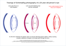 Tracing of Scheimpflug photographs of 20 year old human lens being thicker focusing near and thinner when focusing far. Internal layering of the lens is also significant.