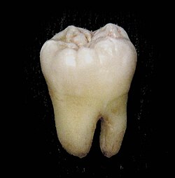 A human molar with four cusps