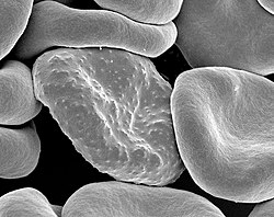 Electron micrograph of a Plasmodium falciparum-infected red blood cell (center), illustrating adhesion protein "knobs"