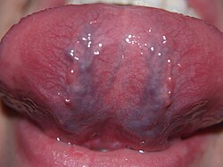 The underside of a human tongue, showing its rich blood supply