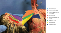 Labelled dorsal musculature of a pigeon wing