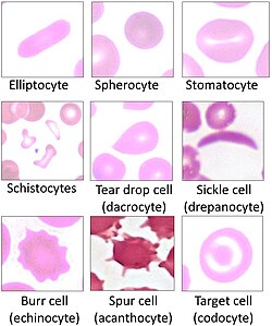 Variations of red blood cell shape, overall termed poikilocytosis