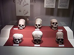 A set of Paracas culture skulls that show a range of different types of cranial modification. The two skulls from the left of the front row are Bilobate.