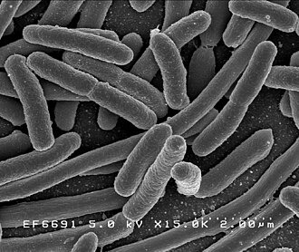 Scanning electron micrograph of Escherichia coli, a common human pathogen and research organism.