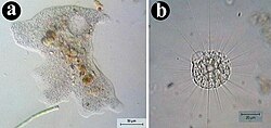 Asymmetrical and spherical body shapes. (a) An organism with an asymmetrical, amoeboid body plan (Amoeba proteus – an amoeba). (b) An organism with a spherical amoeboid body plan (Actinophrys sol – a heliozoan).