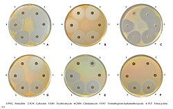 Susceptibility to commonly used antibiotics.