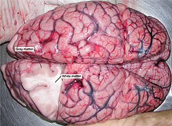 Dissection of a human brain with labels showing the clear division between white and gray matter.