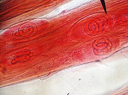 Trichinella spiralis larvae in uncooked pig meat