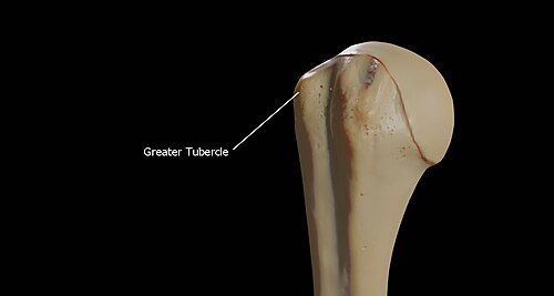 Greater tubercle of the right humerus